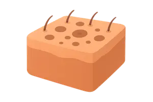 Pigmentary Disorders