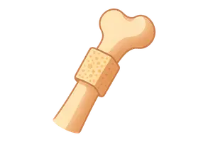 Bone Grafts and Substitutes