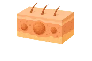 Musculoskeletal & Integumentary Systems