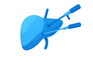 Minimally Invasive Surgery