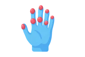 Rheumatology (autoimmune diseases, arthritis)