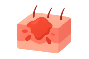 Inflammation and Repair