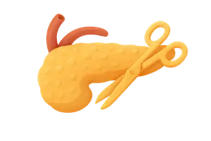 Pancreatic Surgery