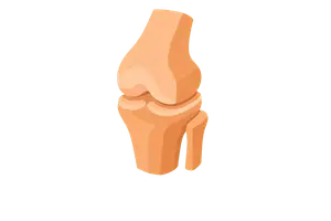 Musculoskeletal Disorders