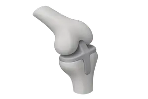 Orthopedic Biomechanics