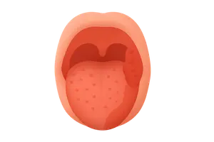 Diseases of the Oral Cavity and Salivary Glands