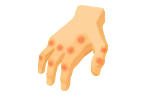Immune & Rheumatologic Disorders