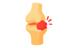 Arthrology and Infections