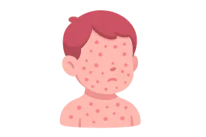 Pediatric Dermatology