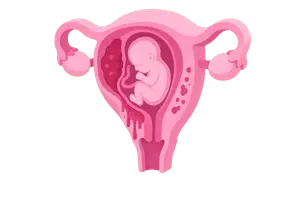 High-Risk Antepartum Complications