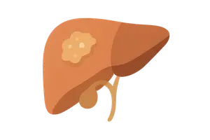 Liver and Biliary Pathology