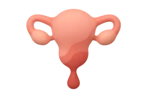 Postpartum hemorrhage