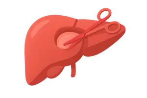 Hepatobiliary Surgery