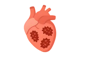Infectious diseases (sepsis, endocarditis)