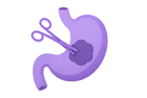 Surgical Oncology Principles