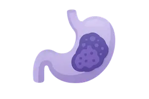 Oncologic Surgery Principles