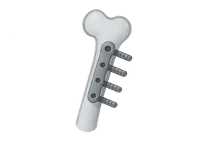 Orthopaedics