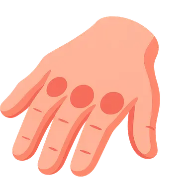 Rheumatoid arthritis