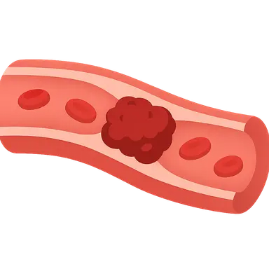 Venous thromboembolism