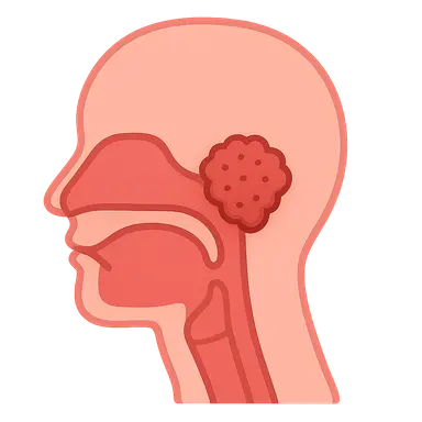 Nasopharyngeal Carcinoma