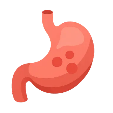 DKA diagnostic criteria