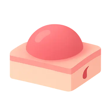 Skin Lesions: Morphology and Description