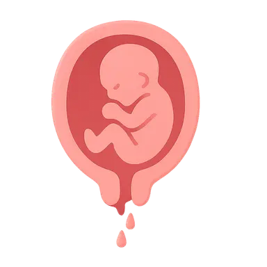 Premature rupture of membranes