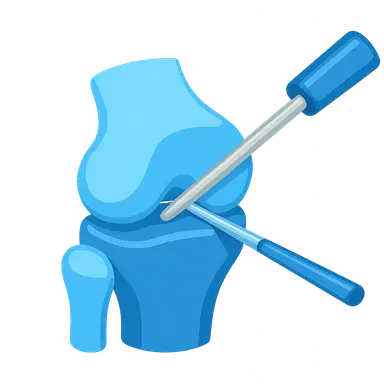 Principles of Arthroscopy