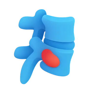 Spondyloarthropathies
