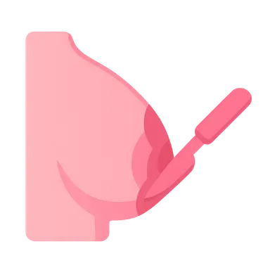 Surgical Management of Breast Cancer