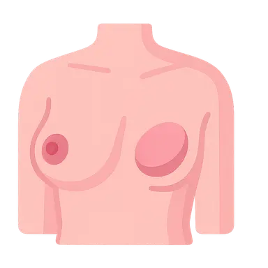 Breast reconstruction options