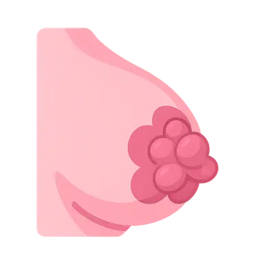 Benign Breast Diseases