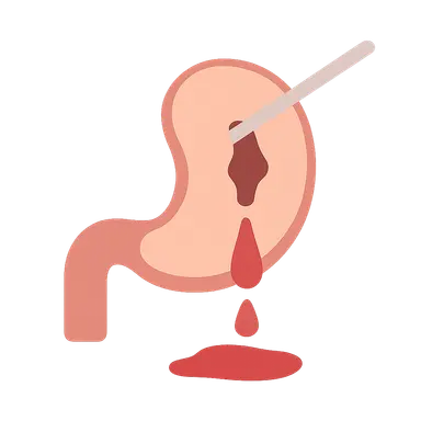 Complications of minimally invasive surgery