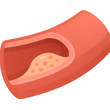 Atherosclerosis