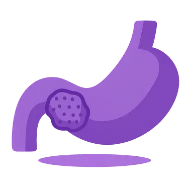 Neoadjuvant and Adjuvant Therapy