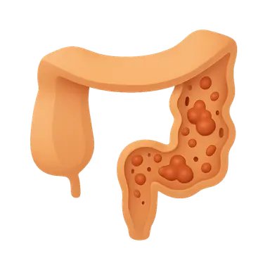 Crohn's disease pathophysiology
