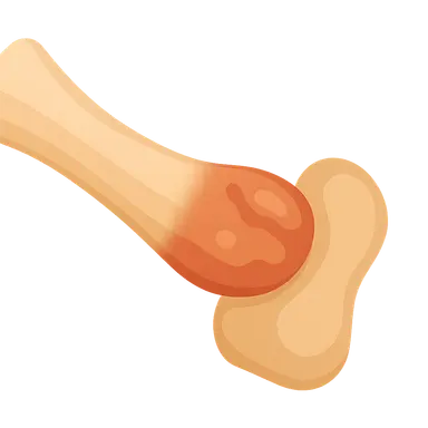 Diseases of Tendons and Fascia