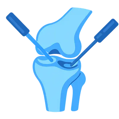 Therapeutic Arthroscopic Procedures