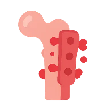 Implant-Related Infections