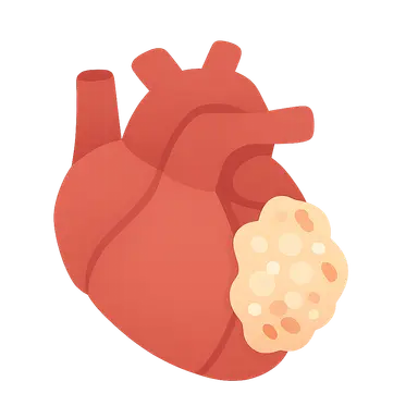 Biofilms in endocarditis