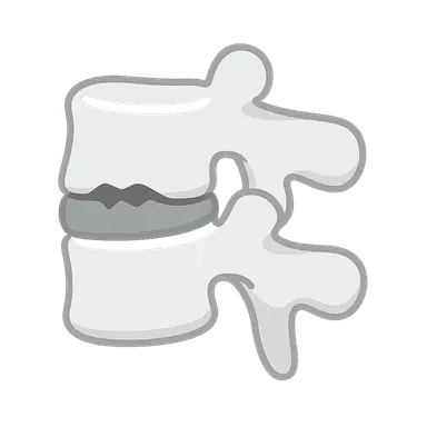 Spine Trauma Imaging