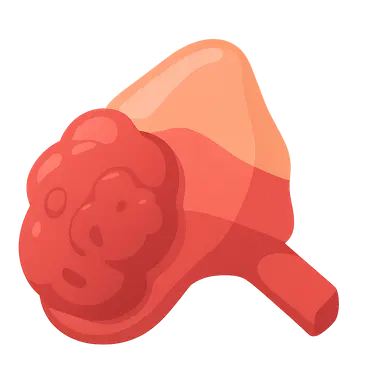 Pheochromocytoma and paraganglioma