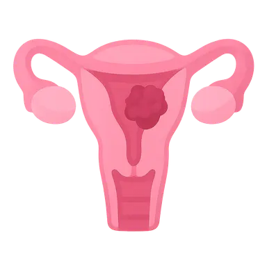Endometrial Cancer