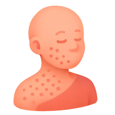 Leukemias in children