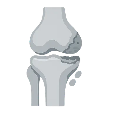 Joints and Rheumatologic Diseases