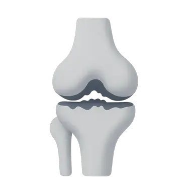 Osteoarthritis of Knee