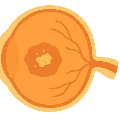 Age-Related Macular Degeneration
