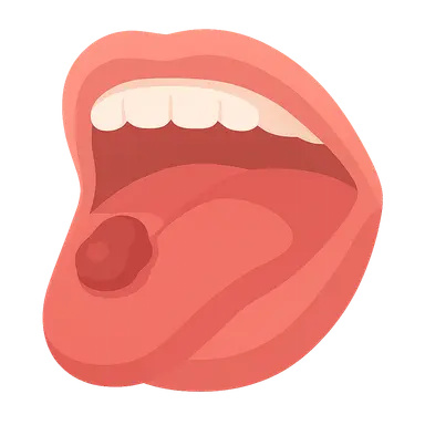Oral Cavity Cancer