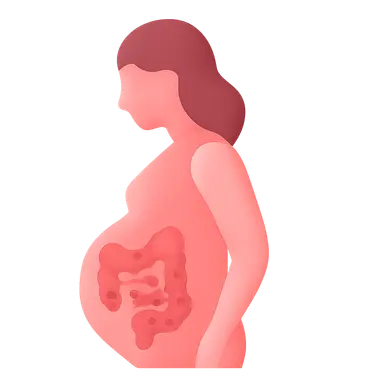 IBD in pregnancy