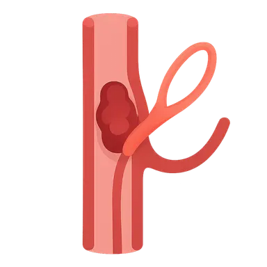 Thromboembolectomy procedures